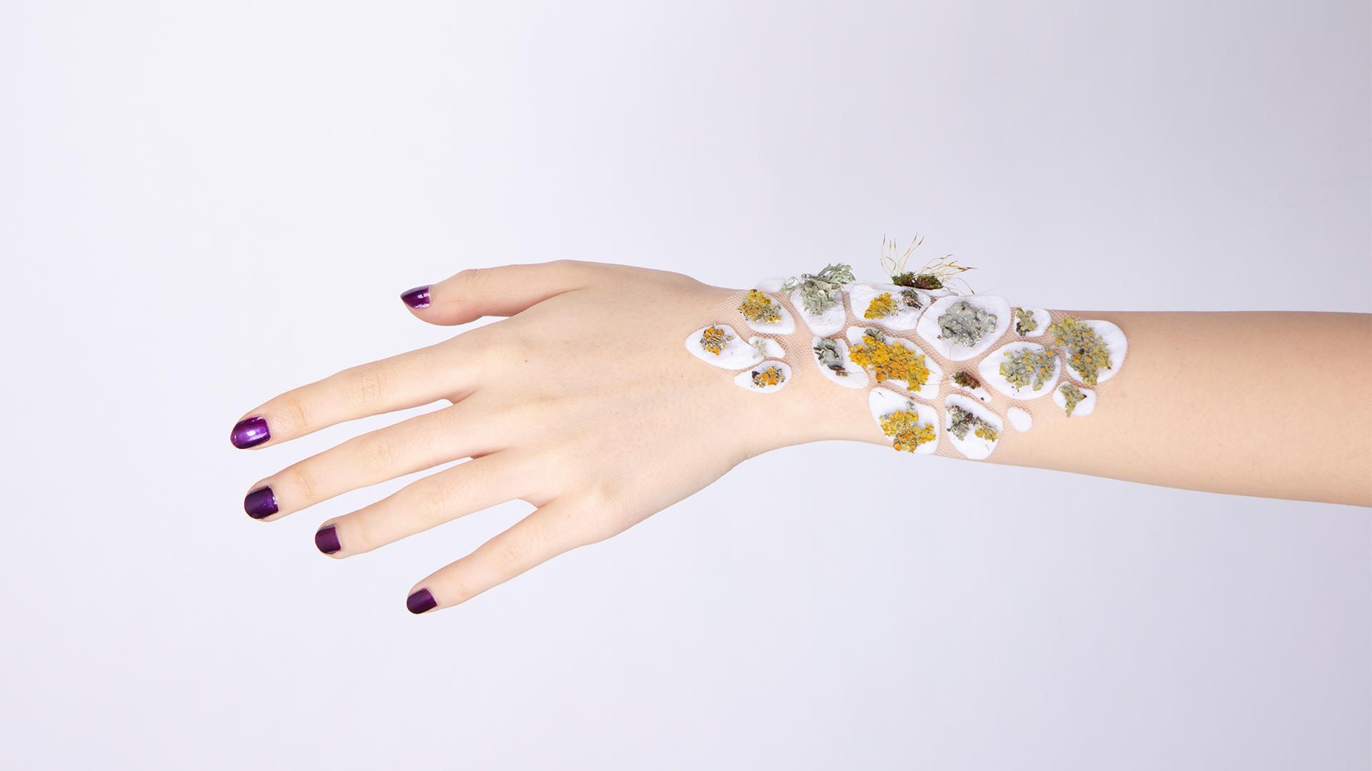 An outstretched hand. White patches that hold lichen and moss are attached to the wrist.